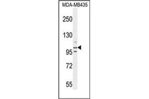 Western blot analysis of PEAR1 Antibody (C-term) in MDA-MB435 cell line lysates (35ug/lane). (PEAR1 anticorps  (C-Term))
