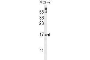 ZNF720 Antibody (Center) western blot analysis in MCF-7 cell line lysates (35 µg/lane). (ZNF720 anticorps  (Middle Region))