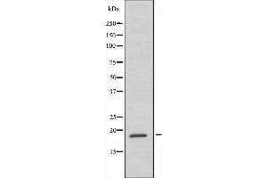 Western blot analysis of extracts from HeLa cells,using RPL35 antibody. (RPL35 anticorps  (C-Term))