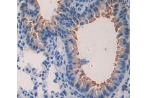 IHC-P analysis of Kidney tissue, with DAB staining. (Surfactant Protein C anticorps  (AA 1-193))