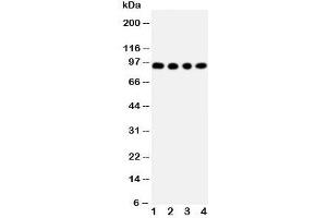 Western blot testing of ADAM17 antibody and Lane 1:  human placenta;  2: HeLa;  3: PANC;  4: 293T cell lysate. (ADAM17 anticorps  (C-Term))