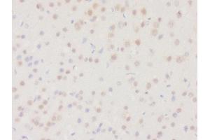 Formalin-fixed and paraffin embedded rat brain tissue labeled with Rabbit Anti-DHRS2 Polyclonal Antibody, Unconjugated (ABIN2559682) at 1:200 followed by conjugation to the secondary antibody and DAB staining
