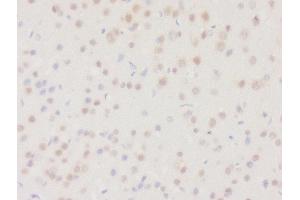 Formalin-fixed and paraffin embedded rat brain tissue labeled with Rabbit Anti-DHRS2 Polyclonal Antibody, Unconjugated (ABIN2559682) at 1:200 followed by conjugation to the secondary antibody and DAB staining (DHRS2 anticorps  (AA 61-160))