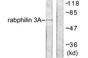 Western blot analysis of extracts from HeLa cells, treated with TNF-a 20ng/ml 2', using Rabphilin 3A (Ab-Ser237) Antibody. (RPH3A anticorps  (AA 203-252))
