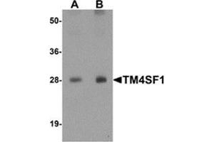 Western blot analysis of TM4SF1 in human lung tissue lysate with TM4SF1 antibody at (A) 0. (TM4SF1 anticorps  (N-Term))