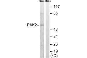 Western blot analysis of extracts from HeLa cells, treated with TSA (400nM, 24hours), using PAK2 (epitope around residue 141) antibody. (PAK2 anticorps  (Ser141))