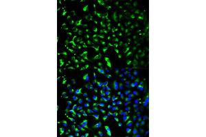 Immunofluorescence analysis of HeLa cell using PHB antibody. (Prohibitin anticorps  (AA 73-272))