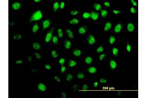 anti-Helicase with Zinc Finger (HELZ) (AA 1-100) antibody