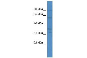 WB Suggested Anti-CA5A Antibody Titration: 0. (CA5A anticorps  (C-Term))