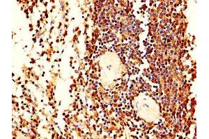 IHC image of ABIN7163556 diluted at 1:400 and staining in paraffin-embedded human spleen tissue performed on a Leica BondTM system. (LCP1 anticorps  (AA 2-627))