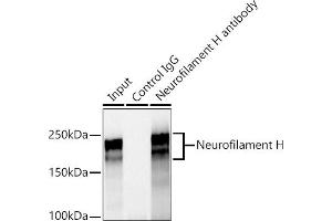 Immunoprecipitation analysis of 600 μg extracts of Rat brain cells using 3 μg Neurofilament H antibody (ABIN7268866). (NEFH anticorps)
