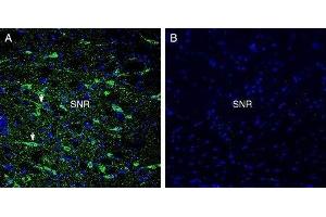 Expression of GPR52 in rat substantia nigra - Immunohistochemical staining of perfusion-fixed frozen rat brain sections with Anti-GPR52 Antibody (ABIN7043161, ABIN7044453 and ABIN7044454), (1:300), followed by goat anti-rabbit-AlexaFluor-488. (GPR52 anticorps  (3rd Intracellular Loop))