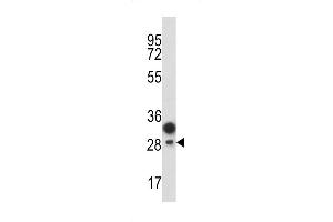 Western blot analysis of CD201 antibody in T47D cell line lysates (35ug/lane)