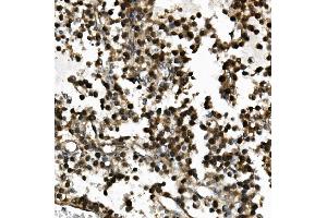 IHC analysis of USP44 using anti-USP44 antibody (ABIN7600640). (USP44 anticorps  (AA 211-712))
