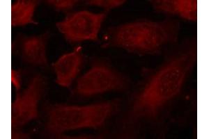 Immunofluorescence staining of methanol-fixed Hela cells using p56Dok-2(Phospho-Tyr299) Antibody. (DOK2 anticorps  (pTyr299))