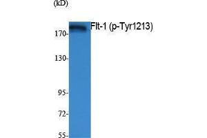 Western Blotting (WB) image for anti-Fms-Related tyrosine Kinase 1 (VEGFR1) (FLT1) (pTyr1213) antibody (ABIN3179854) (FLT1 anticorps  (pTyr1213))