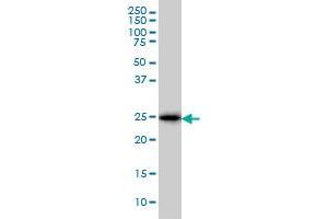CD99 monoclonal antibody (M01), clone 3A10 Western Blot analysis of CD99 expression in K-562 .
