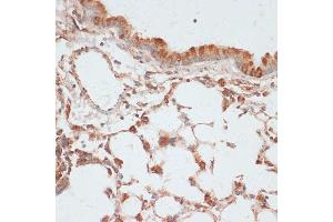 Immunohistochemistry of paraffin-embedded mouse lung using Phospho-VASP-S157 antibody (ABIN6135335, ABIN6136286, ABIN6136287 and ABIN6225657) at dilution of 1:100 (40x lens). (VASP anticorps  (pSer157))