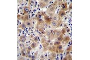 Immunohistochemistry analysis in formalin fixed and paraffin embedded human liver tissue reacted with NEU2 Antibody (N-term) followed which was peroxidase conjugated to the secondary antibody and followed by DAB staining. (NEU2 anticorps  (N-Term))