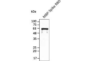 Western Blotting (WB) image for anti-SARS-CoV-2 Spike (RBD) antibody (ABIN7272992) (SARS-CoV-2 Spike anticorps  (RBD))
