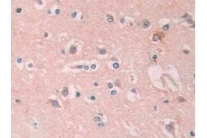 Detection of PTK7 in Human Cerebrum Tissue using Polyclonal Antibody to Tyrosine Protein Kinase 7 (PTK7)