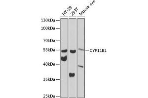 Western blot analysis of extracts of various cell lines, using CYP11B1 antibody (ABIN6130956, ABIN6139312, ABIN6139313 and ABIN6223585) at 1:1000 dilution. (CYP11B1 anticorps  (AA 234-503))