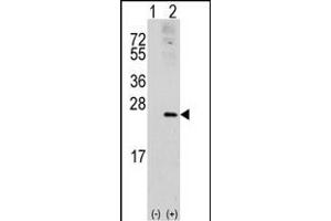 Western blot analysis of RAC1 (arrow) using rabbit polyclonal RAC1 Antibody (S71) (ABIN391836 and ABIN2841676).