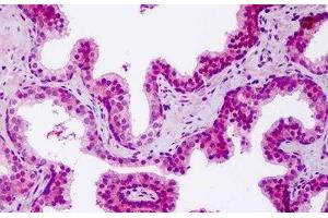 Human Prostate: Formalin-Fixed, Paraffin-Embedded (FFPE) (NOD1 anticorps  (AA 923-951))