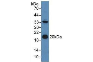 Western blot analysis of Mouse Liver Tissue. (Adrenomedullin anticorps  (AA 24-171))