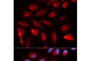 Immunofluorescence analysis of U2OS cells using PPARD Polyclonal Antibody (PPARD anticorps)