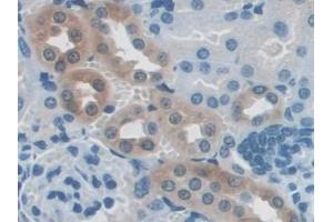 Detection of NXN in Mouse Kidney Tissue using Polyclonal Antibody to Nucleoredoxin (NXN)