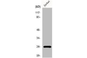 Western Blot analysis of Jurkat cells using Flt3-L Polyclonal Antibody (FLT3LG anticorps  (C-Term))