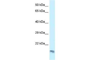 WB Suggested Anti-Sec11c Antibody Titration: 1. (SEC11C anticorps  (C-Term))
