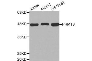Western blot analysis of extracts of various cell lines, using PRMT8 antibody. (PRMT8 anticorps)