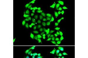 Immunofluorescence analysis of A549 cells using GTF2H3 Polyclonal Antibody (GTF2H3 anticorps)