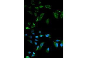 Immunofluorescence analysis of HeLa cells using NEK8 antibody (ABIN5970372).