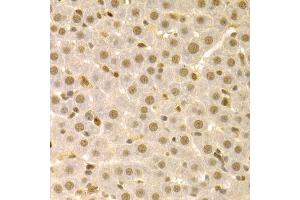 Immunohistochemistry of paraffin-embedded rat liver using SFN Antibody (ABIN5970403) at dilution of 1/100 (40x lens). (14-3-3 sigma/SFN anticorps)