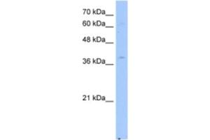 Western Blotting (WB) image for anti-NAD(P) Dependent Steroid Dehydrogenase-Like (NSDHL) antibody (ABIN2463049) (NSDHL anticorps)