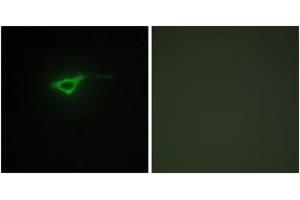 Immunofluorescence (IF) image for anti-Collagen, Type XX, alpha 1 (COL20A1) (AA 1151-1200) antibody (ABIN2889927)