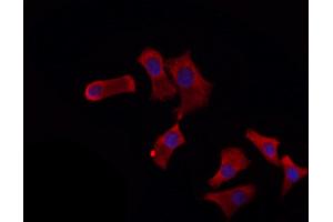 ABIN6260668 and ABIN6272272 staining HepG2 by IF/ICC.