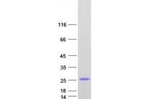 Validation with Western Blot