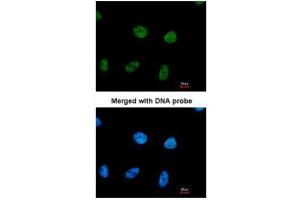 ICC/IF Image Immunofluorescence analysis of paraformaldehyde-fixed HeLa, using RPA 32 kDa subunit , antibody at 1:200 dilution.