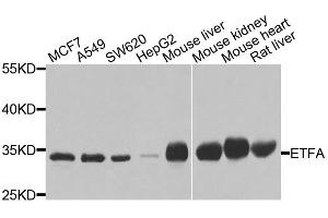 Western blot analysis of extracts of various cell lines, using ETFA antibody (ABIN5975750) at 1/1000 dilution. (ETFA anticorps)