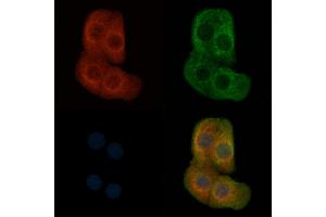 ABIN6257150 and ABIN6274352 staining Hela cells by IF/ICC.