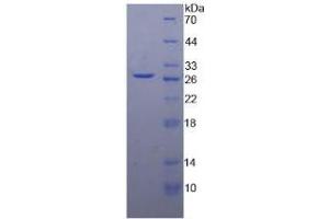 SDS-PAGE analysis of Human DGAT1 Protein. (DGAT1 Protéine)