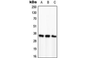 Western blot analysis of PCNA expression in HeLa (A), SP2/0 (B), H9C2 (C) whole cell lysates. (PCNA anticorps  (Center))