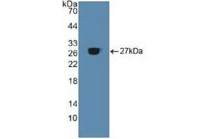 Western blot analysis of recombinant Human ACO1. (Aconitase 1 anticorps  (AA 251-443))
