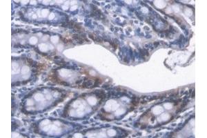 Detection of CBR1 in Mouse Colon Tissue using Polyclonal Antibody to Carbonyl Reductase 1 (CBR1)