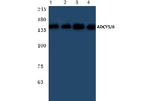 Western blot (WB) analysis of ADCY 5/6 antibody at 1/500 dilution (ADCY5 anticorps)