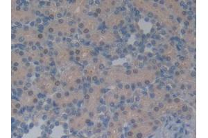 DAB staining on IHC-P; Samples: Rat Kidney Tissue